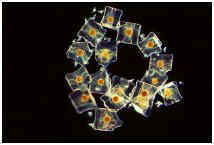 Chain Diatom